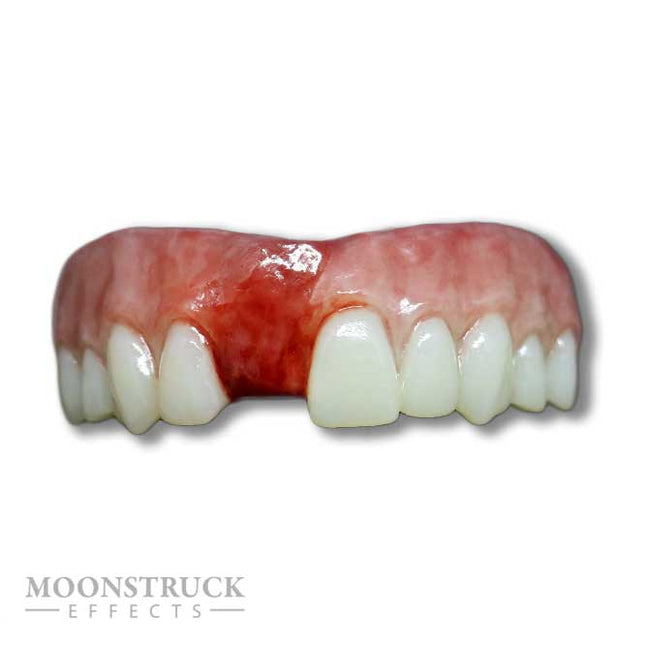 Moonstruck Effects Anwen missing U5 Neptanden